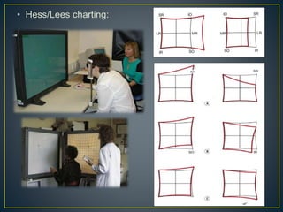 • Hess/Lees charting:
 