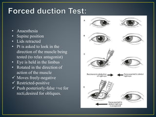 • Anaesthesia
• Supine position
• Lids retracted
• Pt is asked to look in the
direction of the muscle being
tested (to relax antagonist)
• Eye is held in the limbus
• Rotated in the direction of
action of the muscle
 Moves freely-negative
 Restricted-positive
 Push posteriorly-false +ve for
recti,desired for obliques.
 