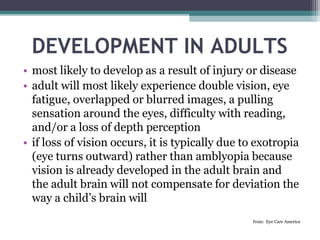 DEVELOPMENT IN ADULTS
• most likely to develop as a result of injury or disease
• adult will most likely experience double vision, eye
fatigue, overlapped or blurred images, a pulling
sensation around the eyes, difficulty with reading,
and/or a loss of depth perception
• if loss of vision occurs, it is typically due to exotropia
(eye turns outward) rather than amblyopia because
vision is already developed in the adult brain and
the adult brain will not compensate for deviation the
way a child’s brain will
from: Eye Care America
 