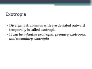 Exotropia
• Divergent strabismus with eye deviated outward
temporally is called exotropia
• It can be infantile exotropia, primary exotropia,
and secondary exotropia
 