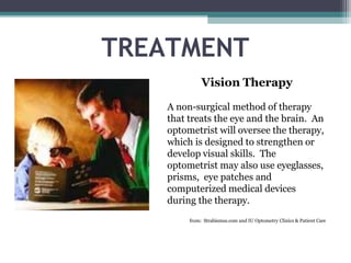 TREATMENT
Vision Therapy
A non-surgical method of therapy
that treats the eye and the brain. An
optometrist will oversee the therapy,
which is designed to strengthen or
develop visual skills. The
optometrist may also use eyeglasses,
prisms, eye patches and
computerized medical devices
during the therapy.
from: Strabismus.com and IU Optometry Clinics & Patient Care
 