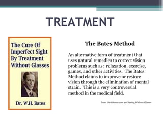 TREATMENT
The Bates Method
An alternative form of treatment that
uses natural remedies to correct vision
problems such as: relaxation, exercise,
games, and other activities. The Bates
Method claims to improve or restore
vision through the elimination of mental
strain. This is a very controversial
method in the medical field.
from: Strabismus.com and Seeing Without Glasses
 