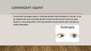 STRABISMUS.pptx