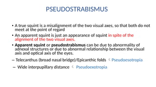 Visual Squint Comprehensive Visual Acuity Assessment and Strabismus-Induced Amblyopia ...