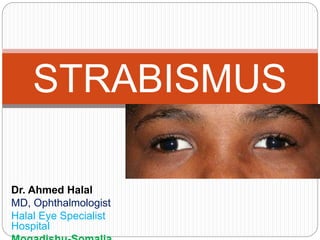 Dr. Ahmed Halal
MD, Ophthalmologist
Halal Eye Specialist
Hospital
STRABISMUS
 