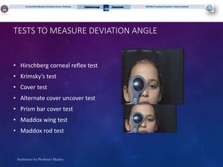 Strabismus squint evaluation and management | PPT