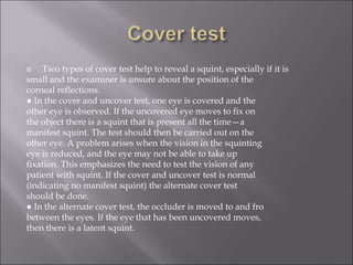 Strabismus (1).ppt