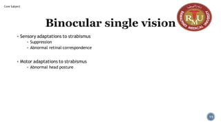 Binocular single vision
▪ Sensory adaptations to strabismus
▪ Suppression
▪ Abnormal retinal correspondence
▪ Motor adaptations to strabismus
▪ Abnormal head posture
Core Subject
11
 