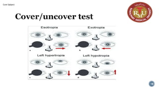 Cover/uncover test
18
Core Subject
 