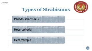 Types of Strabismus
Psuedo-strabismus
Heterophoria
Heterotropia
23
Core Subject
 