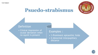 Psuedo-strabismus
Definition
• Clinical impression of
ocular deviation when
no squint is present
Examples :
• 1-Prominent epicanthic folds
• 2-Abnormal interpupillary
distance
24
Core Subject
 