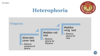 Heterophoria
▪Diagnosis
Alternate
cover test
• Detects
presence of
phoria
Maddox rod
test
• Detects
phoria for
distance
Maddox
wing test
• Detects
phoria for
near
27
Core Subject
 