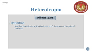 Heterotropia
Definition
Manifest deviation in which visual axes don’t intersect at the point of
deviation
Manifest squint
30
Core Subject
 