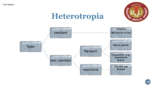 Heterotropia
Types
comitant
Infantile
Refractive errors
non- comitant
Paralytic
Nerve palsies
myopathies e.g;
myasthenia
gravis
restrictive
Thyroid eye
disease
32
Core Subject
 
