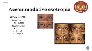 Accommodative esotropia
▪ AC/Aratio– 3-5PD
1. Refractive
▪ Rx– glasses
2. Non refractive
▪ Rx–
a. bifocals
b. surgical
37
Core Subject
 