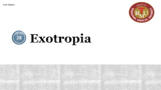 Exotropia
38
Core Subject
 