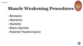 Muscle Weakening Procedures
➢Recession
➢Myectomy
➢Myotomy
➢Botox Injection
➢Posterior Fixation Suture
44
Core Subject
 