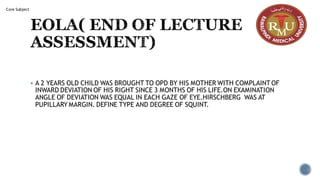 EOLA( END OF LECTURE
ASSESSMENT)
▪ A 2 YEARS OLD CHILD WAS BROUGHT TO OPD BY HIS MOTHER WITH COMPLAINT OF
INWARD DEVIATION OF HIS RIGHT SINCE 3 MONTHS OF HIS LIFE.ON EXAMINATION
ANGLE OF DEVIATION WAS EQUAL IN EACH GAZE OF EYE.HIRSCHBERG WAS AT
PUPILLARY MARGIN. DEFINE TYPE AND DEGREE OF SQUINT.
Core Subject
 