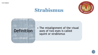 Strabismus
• The misalignment of the visual
axes of two eyes is called
squint or strabismus
Definition
6
Core Subject
 