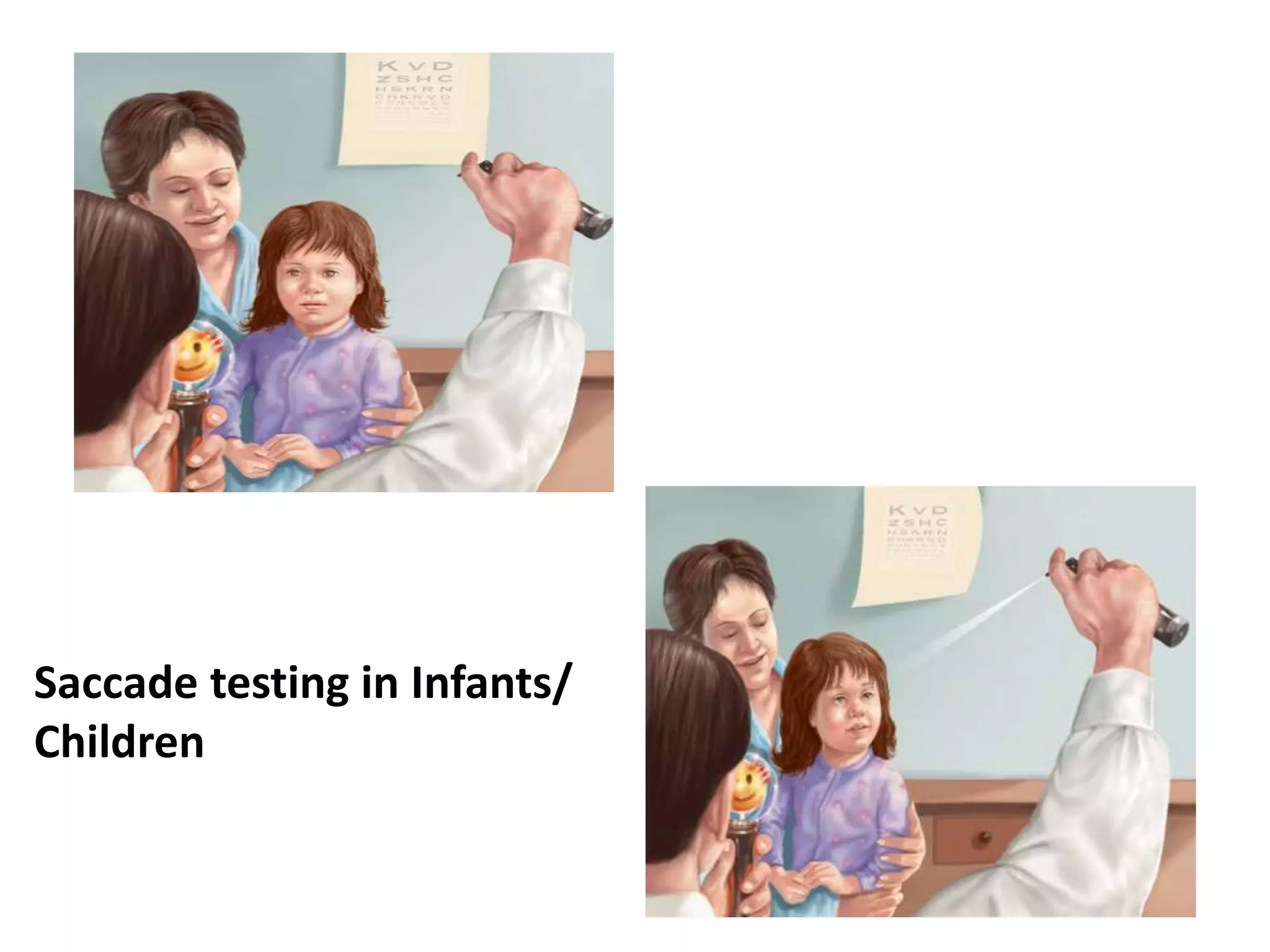 Saccade testing in Infants/
Children
 