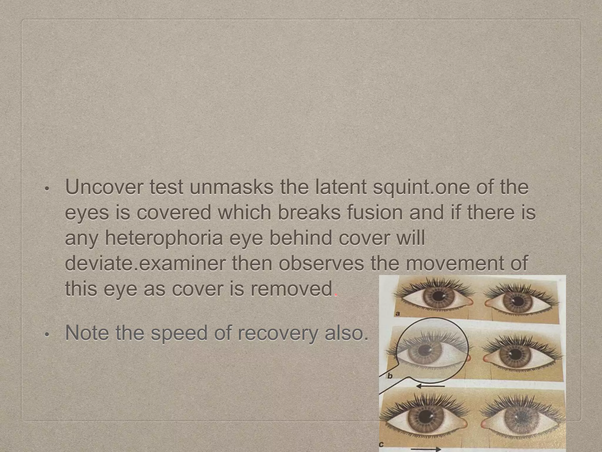• Uncover test unmasks the latent squint.one of the
eyes is covered which breaks fusion and if there is
any heterophoria eye behind cover will
deviate.examiner then observes the movement of
this eye as cover is removed.
• Note the speed of recovery also.
 