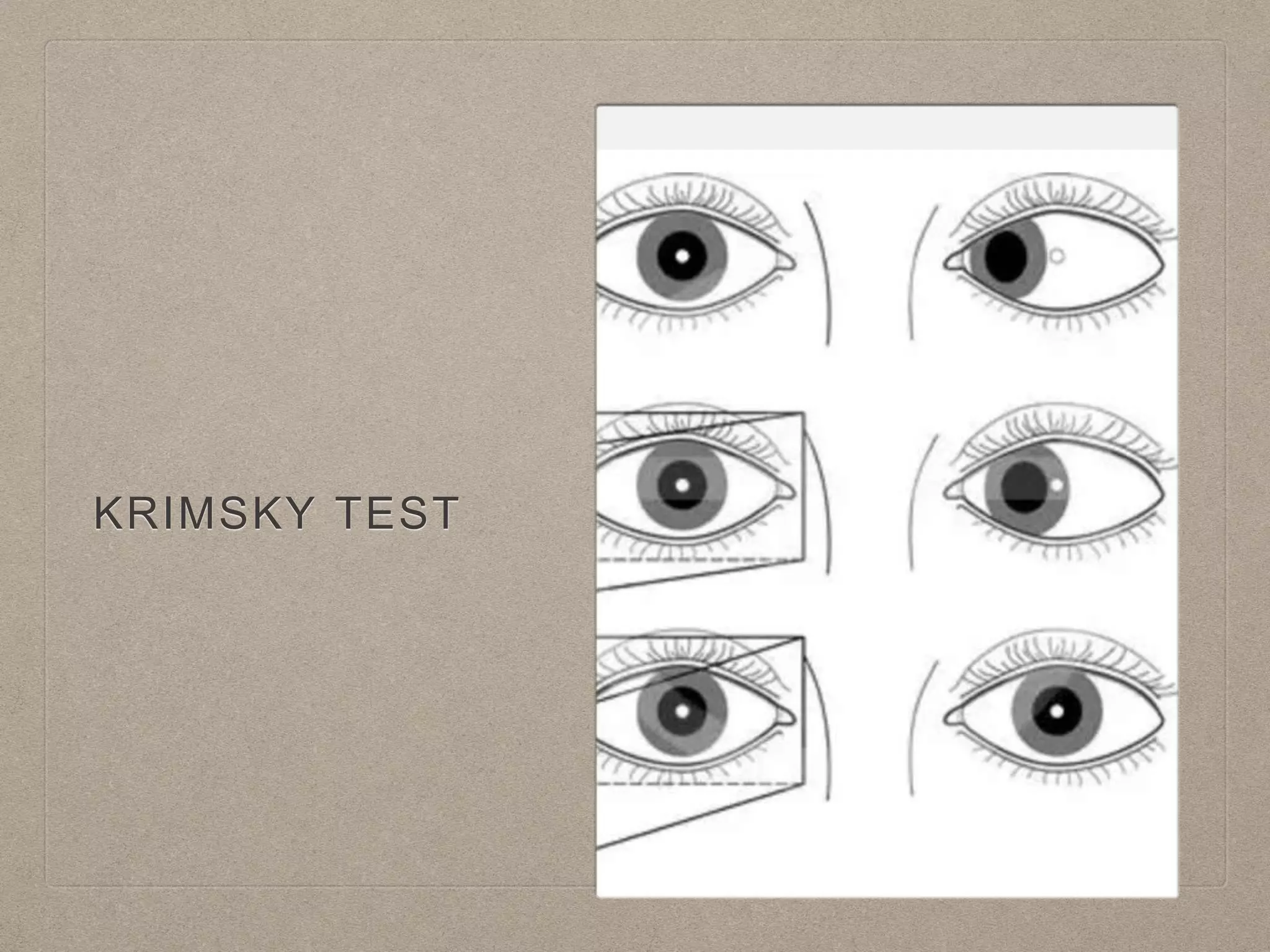 KRIMSKY TEST
 