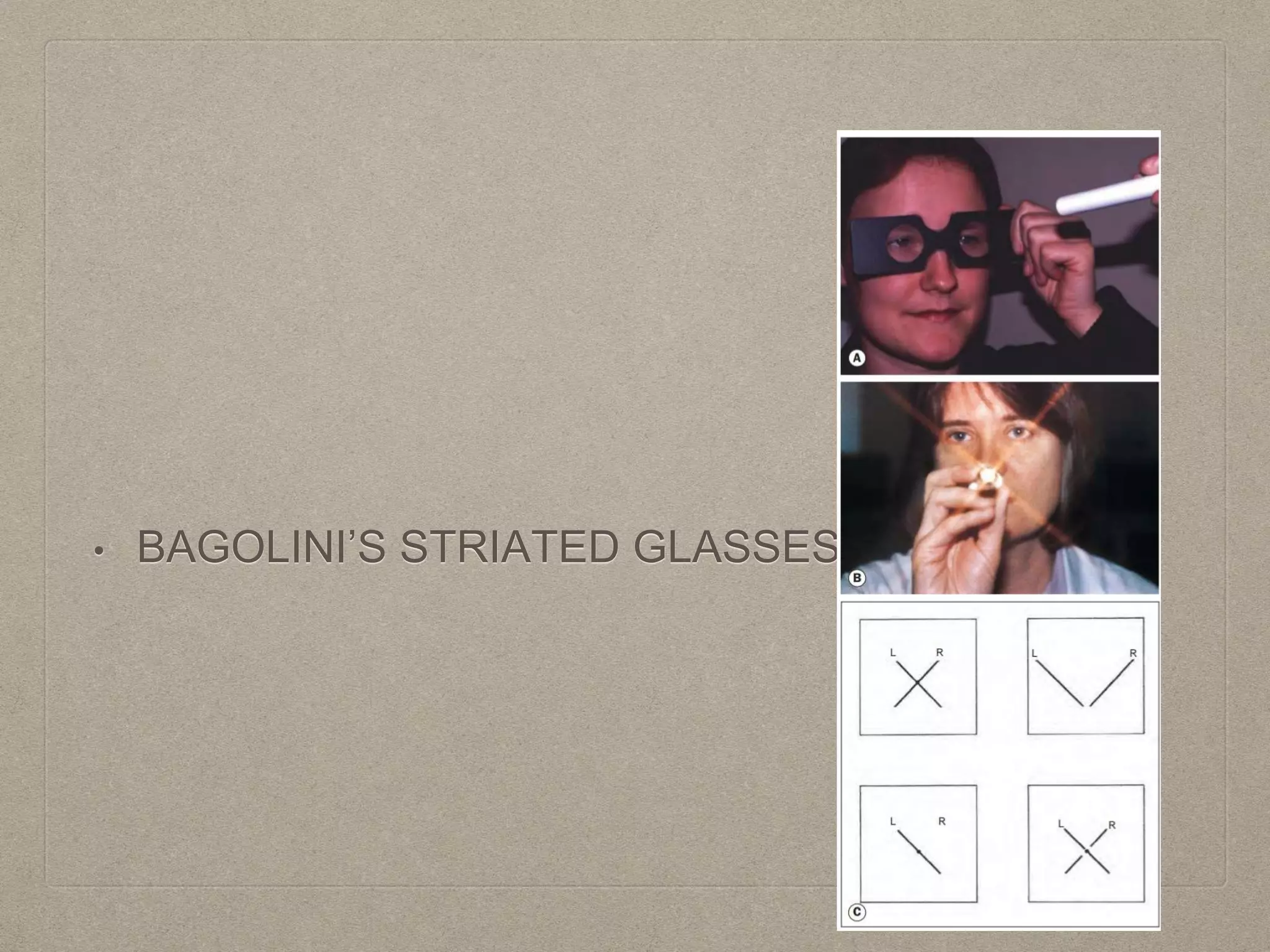 • BAGOLINI’S STRIATED GLASSES
 