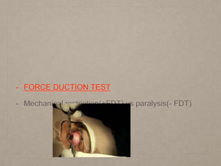 approach to a strabismus patient | PPTX