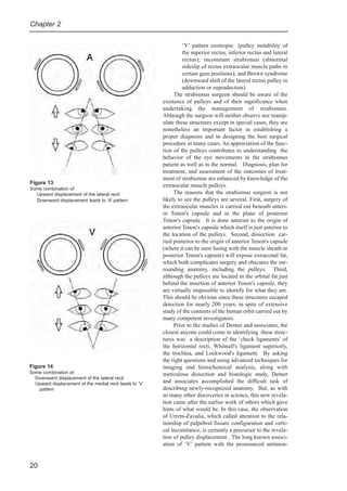 Strabismus Surgical Management of strabismus EHelveston.pdf