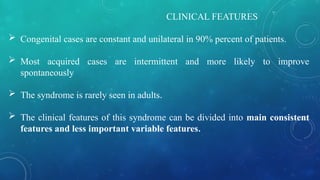 CLINICAL FEATURES
 Congenital cases are constant and unilateral in 90% percent of patients.
 Most acquired cases are intermittent and more likely to improve
spontaneously
 The syndrome is rarely seen in adults.
 The clinical features of this syndrome can be divided into main consistent
features and less important variable features.
 