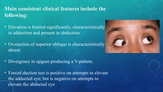 Main consistent clinical features include the
following:
• Elevation is limited significantly, characteristically
in adduction and present in abduction.
• Overaction of superior oblique is characteristically
absent
• Divergence in upgaze producing a V-pattern.
• Forced duction test is positive on attempts to elevate
the adducted eye; but is negative on attempts to
elevate the abducted eye
 