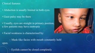 Clinical features
• Abduction is usually limited in both eyes.
• Gaze palsy may be there
• Usually, eyes are straight in primary position,
a few patients may have esotropia
• Facial weakness is characterised by:
– Mask-like facies with mouth constantly held
open.
– Eyelids cannot be closed completely
 