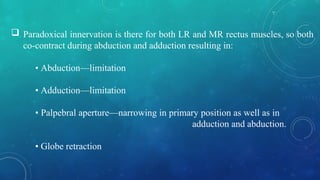  Paradoxical innervation is there for both LR and MR rectus muscles, so both
co-contract during abduction and adduction resulting in:
• Abduction—limitation
• Adduction—limitation
• Palpebral aperture—narrowing in primary position as well as in
adduction and abduction.
• Globe retraction
 