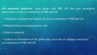 On attempted adduction, since along with MR, LR also gets anomalous
innervation, so due to contraction of MR and LR:
• Adduction is present but limited, due to co contraction of MR and LR
• Palpebral fissure becomes narrow, and
• Globe is retracted,
• Upshoot or downshoot of the globe may occur due to slippage caused by
co-contraction of MR and LR.
 
