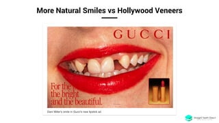 More Natural Smiles vs Hollywood Veneers
 