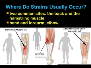  two common sites: the back and the
hamstring muscle
 hand and forearm, elbow
 