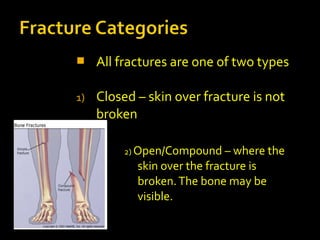  All fractures are one of two types
1) Closed – skin over fracture is not
broken
2) Open/Compound – where the
skin over the fracture is
broken.The bone may be
visible.
 