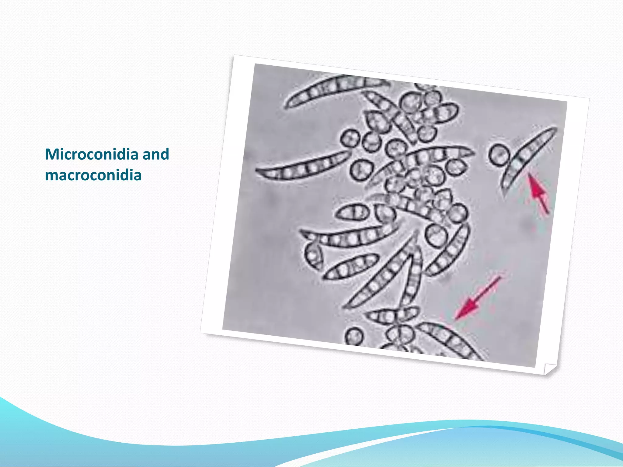 Microconidia and
macroconidia
 