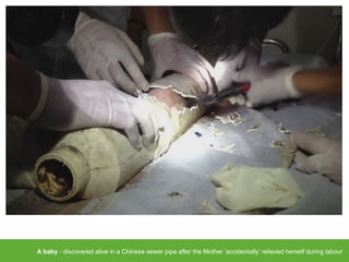 A baby - discovered alive in a Chinese sewer pipe after the Mother ‘accidentally’ relieved herself during labour
 