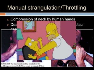Manual strangulation/Throttling
 Compression of neck by human hands
 Death- vagal stimulation  sudden cardiac
death
 
