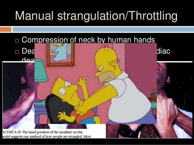 Strangulation