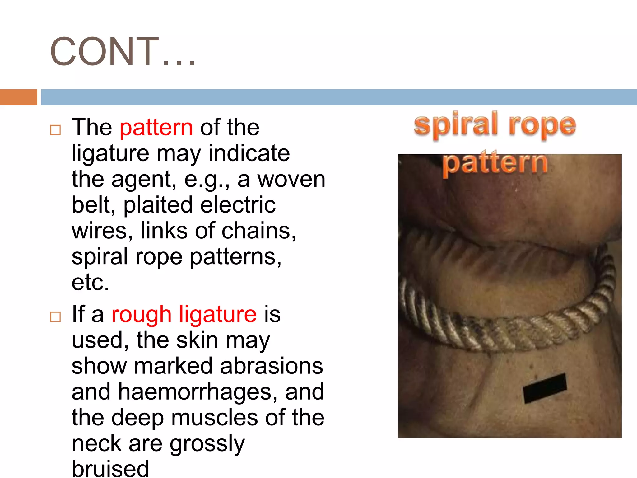 Strangulation | PPTX