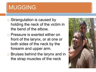 Strangulation