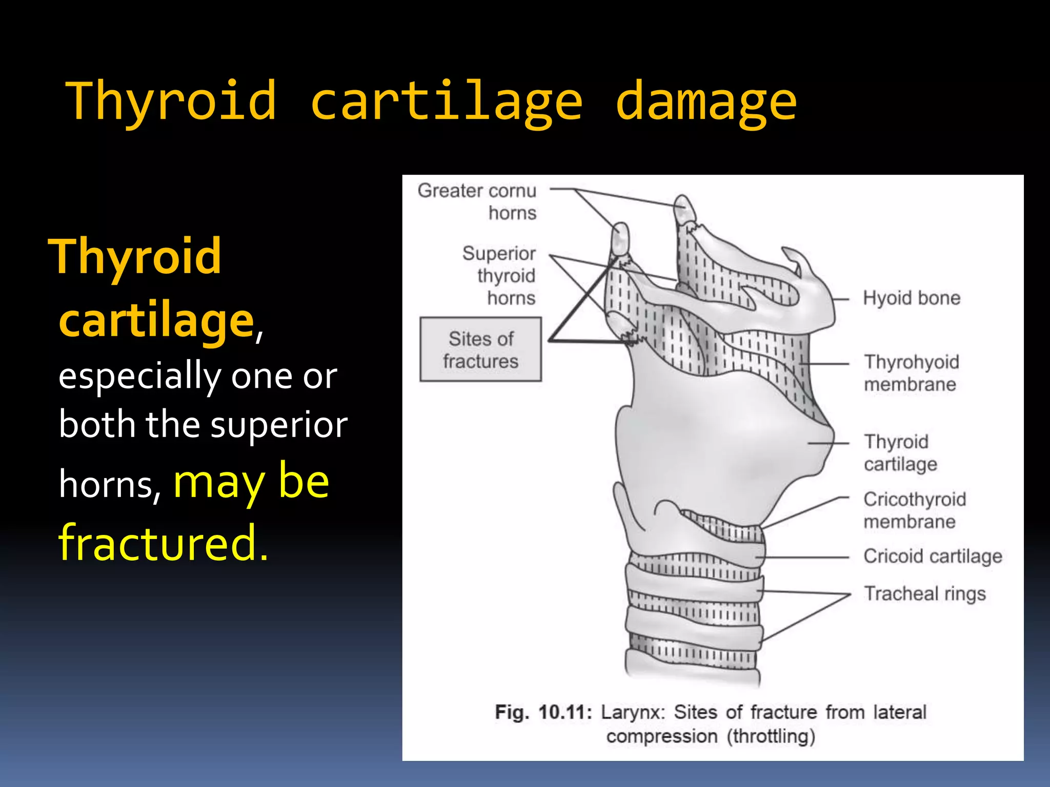 Strangulation a forensic view | PPTX