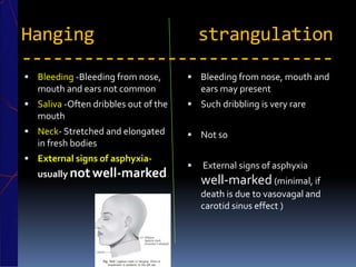 Hanging strangulation
------------------------------
 Bleeding -Bleeding from nose,
mouth and ears not common
 Saliva -Often dribbles out of the
mouth
 Neck- Stretched and elongated
in fresh bodies
 External signs of asphyxia-
usually notwell-marked
 Bleeding from nose, mouth and
ears may present
 Such dribbling is very rare
 Not so
 External signs of asphyxia
well-marked (minimal, if
death is due to vasovagal and
carotid sinus effect )
 