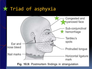 Triad of asphyxia
 