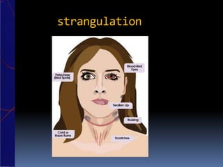 strangulation
 