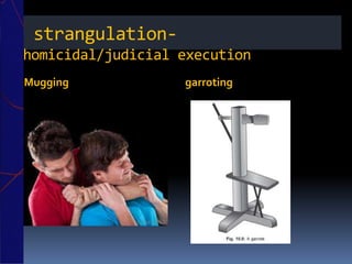 strangulation-
homicidal/judicial execution
Mugging garroting
 