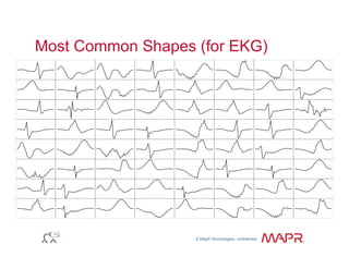 © MapR Technologies, confidential
®
Most Common Shapes (for EKG)
 