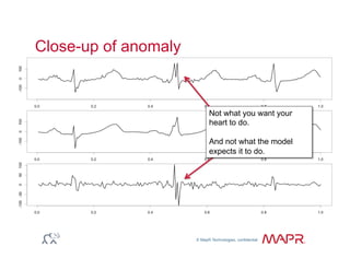 © MapR Technologies, confidential
®
Close-up of anomaly
Not what you want your
heart to do.
And not what the model
expects it to do.
 